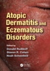 Image for Atopic Dermatitis and Eczematous Disorders