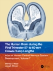 Image for The Human Brain During the First Trimester 57- To 60-Mm Crown-Rump Lengths : 7