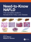 Image for Need-to-Know NAFLD: The Complete Guide to Nonalcoholic Fatty Liver Disease