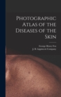 Image for Photographic Atlas of the Diseases of the Skin