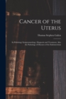 Image for Cancer of the Uterus