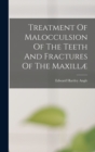 Image for Treatment Of Malocculsion Of The Teeth And Fractures Of The Maxillæ