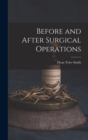 Image for Before and After Surgical Operations