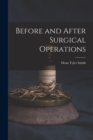 Image for Before and After Surgical Operations