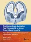 Image for The Human Brain during the First Trimester 57- to 60-mm Crown-Rump Lengths