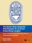 Image for The Human Brain during the First Trimester 40- to 42-mm Crown-Rump Lengths
