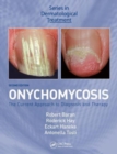 Image for Onychomycosis