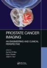Image for Prostate Cancer Imaging