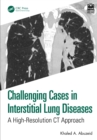 Image for Challenging Cases in Interstitial Lung Diseases