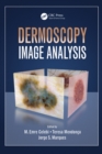 Image for Dermoscopy Image Analysis