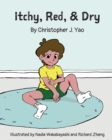 Image for Itchy, Red, &amp; Dry