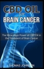 Image for CBD Oil for Brain Cancer