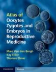 Image for Atlas of Oocytes, Zygotes and Embryos in Reproductive Medicine Hardback with CD-ROM