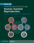 Image for Atlas of vitrified blastocysts in human assisted reproduction