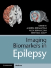 Image for Imaging biomarkers in epilepsy