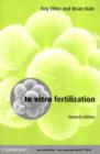 Image for In vitro fertilization