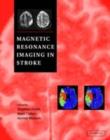 Image for Magnetic resonance imaging in stroke