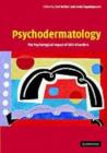 Image for Psychodermatology: the psychological impact of skin disorders
