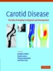 Image for Carotid disease: the role of imaging in diagnosis and management
