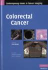 Image for Colorectal cancer