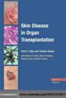 Image for Skin disease in organ transplantation