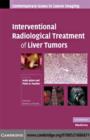 Image for Interventional radiological treatment of liver tumors