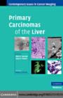 Image for Primary carcinomas of the liver