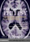 Image for The causes of epilepsy: common and uncommon causes in adults and children