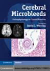 Image for Cerebral microbleeds: from pathophysiology to clinical practice