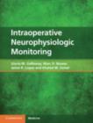 Image for Intraoperative Neurophysiologic Monitoring