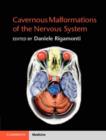 Image for Cavernous malformations of the nervous system