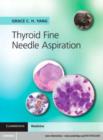 Image for Thyroid fine needle aspiration