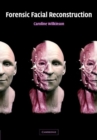 Image for Forensic facial reconstruction [electronic resource] /  Caroline Wilkinson. 