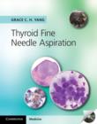 Image for Thyroid Fine Needle Aspiration with CD Extra