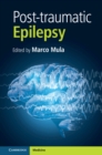 Image for Post-traumatic epilepsy