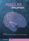Image for Insular Epilepsies