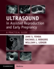 Image for Ultrasound in assisted reproduction and early pregnancy  : a practical guide