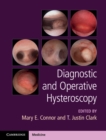 Image for Diagnostic and operative hysteroscopy