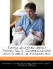 Image for Twins and Conjoined Twins