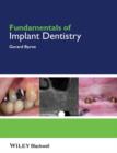 Image for Fundamentals of Implant Dentistry