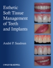 Image for Esthetic Soft Tissue Management of Teeth and Implants