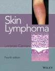 Image for Skin lymphoma  : the illustrated guide