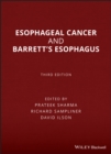 Image for Esophageal cancer and Barrett&#39;s esophagus