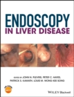 Image for Endoscopy in liver disease