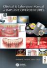 Image for Clinical and laboratory manual of implant overdentures