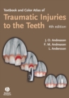 Image for Textbook and color atlas of traumatic injuries to the teeth.