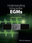 Image for Understanding intracardiac EGMs: a patient centered guide
