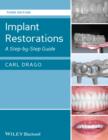 Image for Implant restorations: a step by step guide