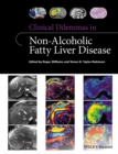 Image for Clinical Dilemmas in Non-Alcoholic Fatty Liver Disease