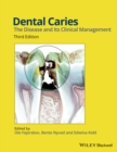Image for Dental Caries : The Disease and its Clinical Management
